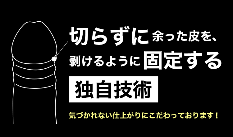 切らずに余った皮を剥けるように固定する独自技術